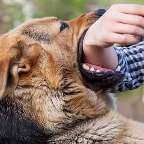 Chó cắn tay người khi chơi đùa ngoài trời.